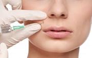 Dermal Fillers suppliers      Filorga NCTF 135HA     Stylage Lips Lido