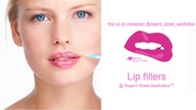Lip Fillers Watford